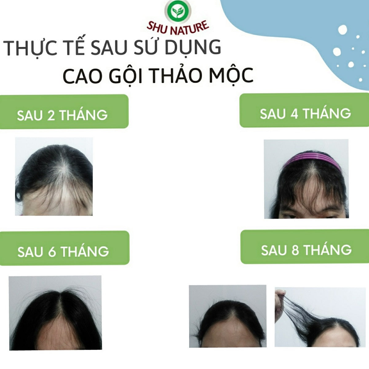 tóc chẻ ngọn  Báo Phụ Nữ Việt Nam